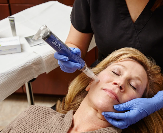 Bellissimo Dolce MedSpa in Metairie, LA: Microneedling with SkinPen Precision Bannner