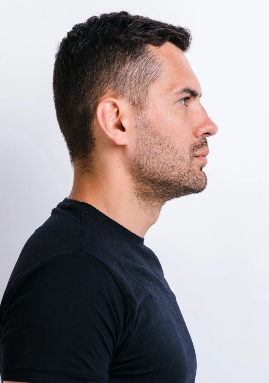 Recovery After Male Rhinoplasty Metairie LA Banner